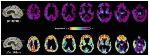 Negative And Positive C Pib Pet Images C Pib Pet Images Taken