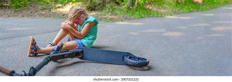 414 Electric Scooter Injury Images Stock Photos Vectors Shutterstock