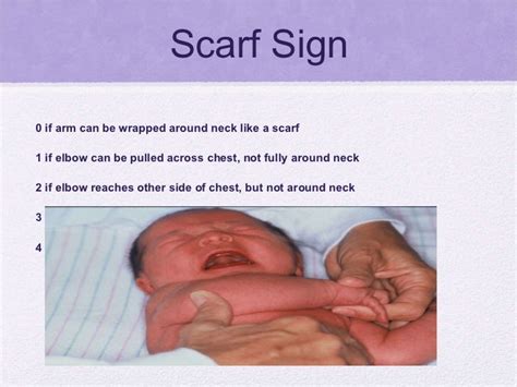 Newborn Health Assessment