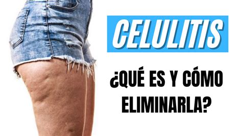 C Mo Eliminar La Celulitis Y La Retenci N De L Quidos Trucos