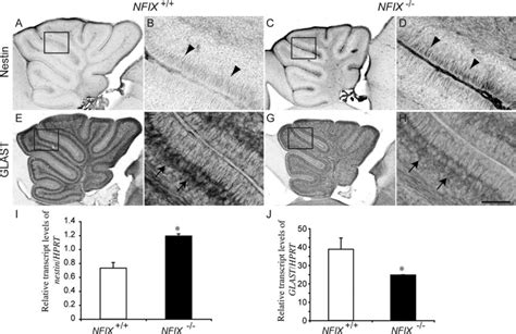 Delayed Differentiation Of Progenitors In The Nfix Cerebellum