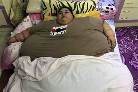 Worlds Heaviest Woman In Process To Lose The Tag Reduces 100kg Ahead