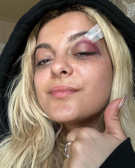 Man Who Assaulted Bebe Rexha With A Cell Phone Has Already Been