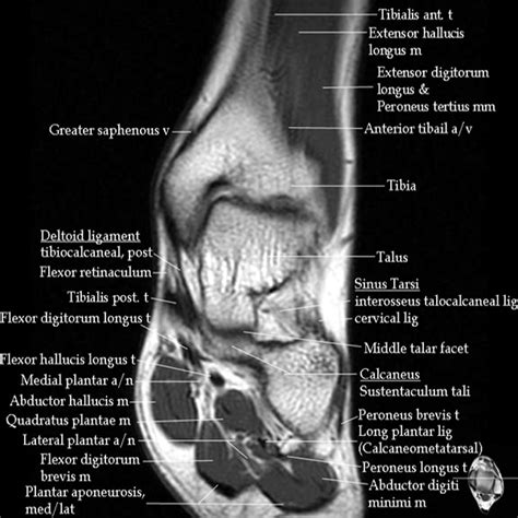 Medial Ankle Ligaments Mri