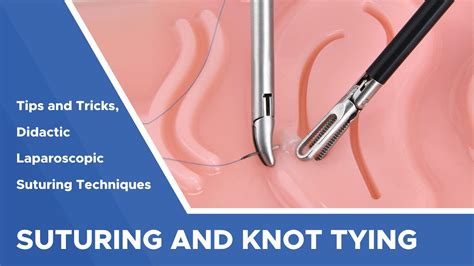 Tips And Tricks For Laparoscopic Suturing And Knot Tying Advancing