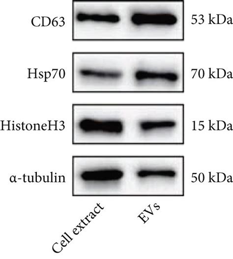 Identification Of HADSC EVs And CGRP Expression In HADSC EVs A