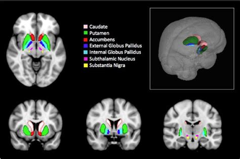 Basal Ganglia Horizontal A Coronal B D And E D Representation