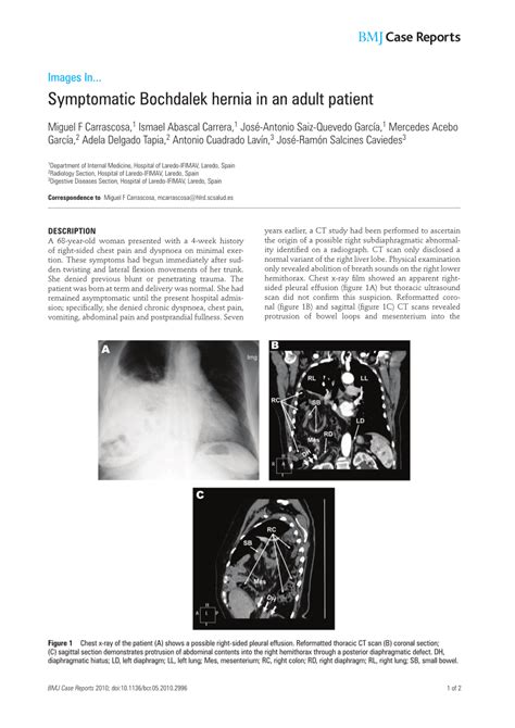 PDF Symptomatic Bochdalek Hernia In An Adult Patient