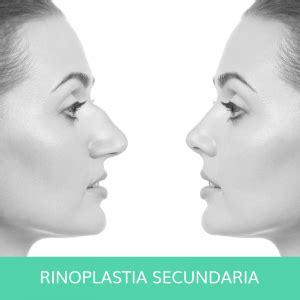 Rinoplastia Secundaria Dr Axel Hemmingsen