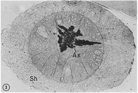 Light Microscope Autoradiograph Of A Cross Section Of The Right