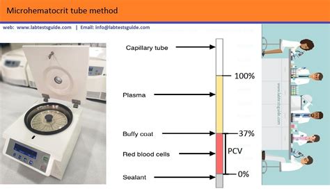 Micro Hematocrit Capillary Tube Reader At Randy Eubanks Blog