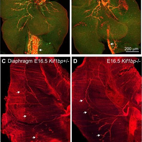 Loss Of Kif Bp Results In Decreased Vagal Fibers In The Lungs But Does