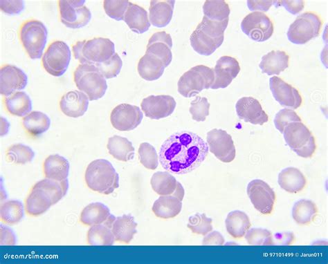 Neutrophil Cell In Blood Smear Stock Photography | CartoonDealer.com ...