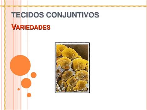 Ppt Tecidos Conjuntivos Variedades Powerpoint Presentation Free