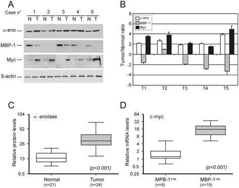 Relative Expression Of Enolase Mbp And Myc In Primary Breast