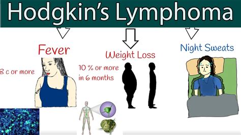 Hodgkins Lymphoma Hodgkins Disease Symptoms And Treatment How To Detect Lymphoma Youtube