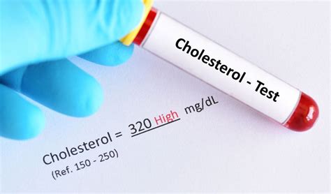 Understanding High Cholesterol And Its Impact On Your Health Edranks