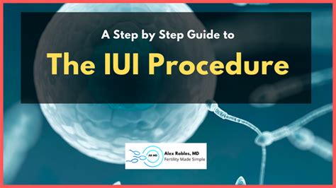 The IUI Procedure A Step By Step Guide Explained Simply Alex