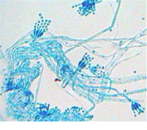 Figure From Production And Purification Of Pectinase By Soil Isolate