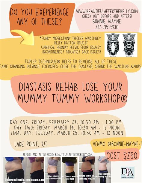 What exercises can i do with a Diastasis Recti? Cardio? Sports? Abs