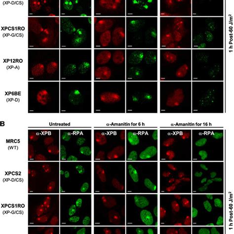 Effects Of Transcription Inhibition On H2ax Phosphorylation And Rpa