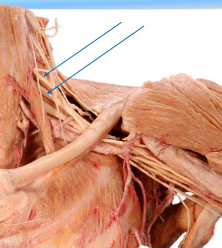 B4W3 Brachial Plexus Flashcards Quizlet