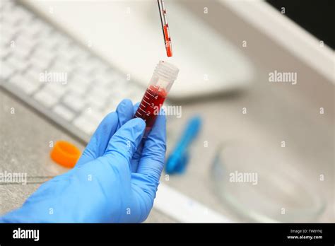 Scientist Working With Blood Sample In Laboratory Stock Photo Alamy