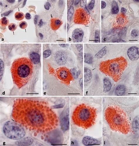 ChAE Activity In Mast Cells Submucosa Of The Jejunum A Ce