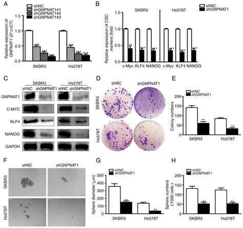 Gnpnat Promotes The Stemness Of Breast Cancer And Serves As A