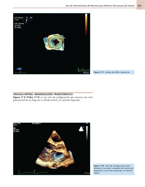Libro Atlas De Ecocardiograf A En D Era Edici N En Campus