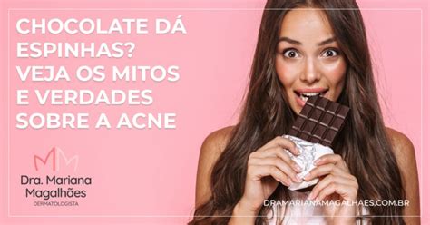 Chocolate D Espinhas Dermatologista Explica Mitos E Verdades Sobre A Acne