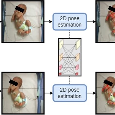 Pdf A D Pose Estimation Framework For Preterm Infants Hospitalized