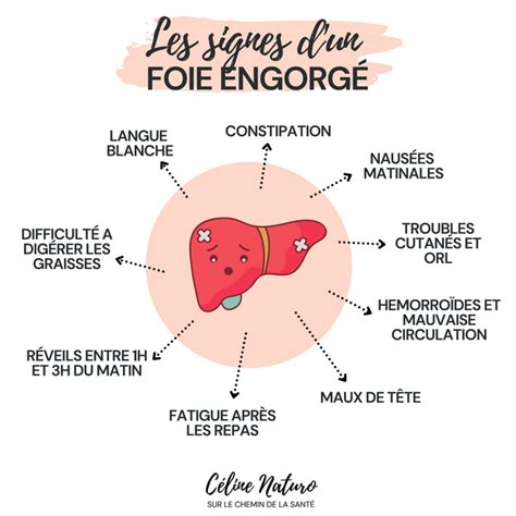 Fiche pratique Les signes d un foie engorgé