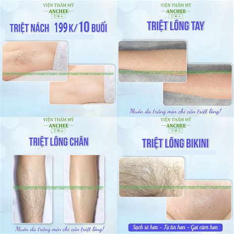 Triệt Lông BIKINI Tạo Hình Mẫu Lông HOT ĐẸP nhất Năm