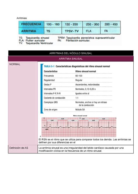 Trastornos Ritmo Arritmias Arritmias Del N Dulo Sinusal Arritmia