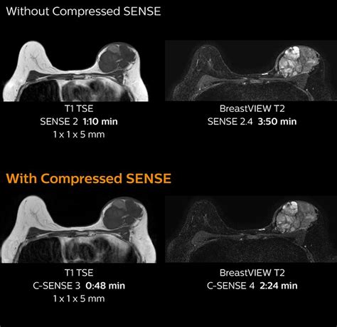 High Quality And Fast MRI At KCH FieldStrength Philips