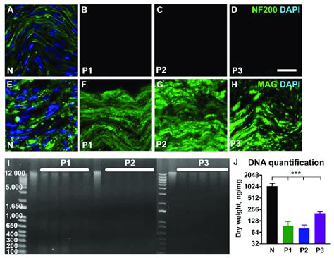 Characterization Of The Decellularized Nerve Tissue Representative