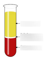 Hematology Unit Diagram Quizlet