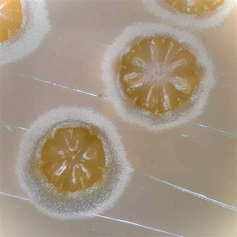 Anton Van Microbiology On Instagram More Beautiful Actinomycetes