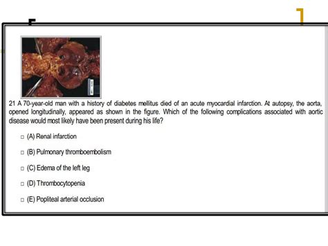 MCQs Hemodynamic Disorders Thromboembolic Disease Shock By DR