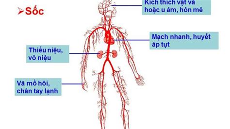 S C Gi M Th T Ch Hi U R Nguy N Nh N Tri U Ch Ng V C Ch X Tr