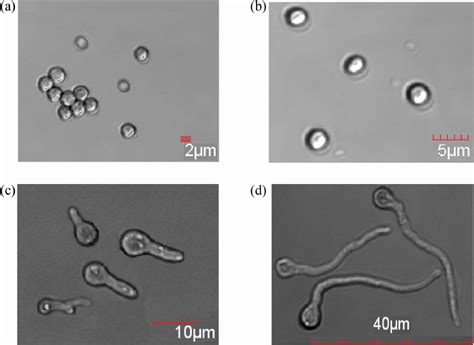 The Differing Morphological Stages Of A Fumigatus Growth As Time