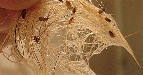 How To Know If You Have Fleas In Your House Ehow Uk