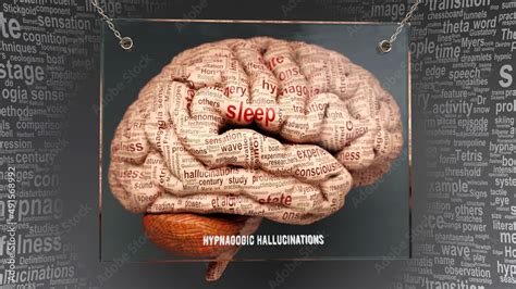 Hypnagogic hallucinations anatomy - its causes and effects projected on ...