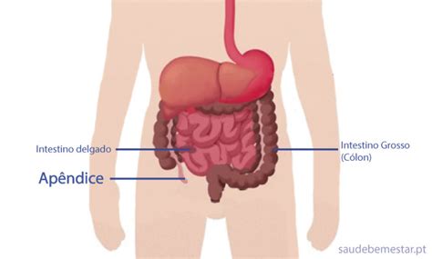 O Que Apendicite Veja As Causas Sintomas E Tratamento