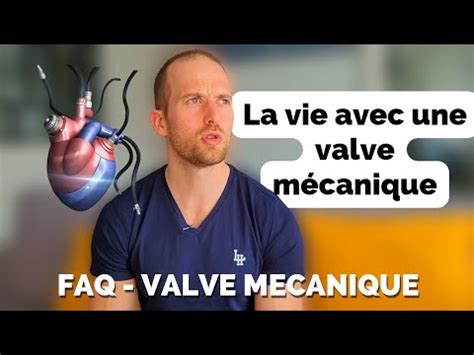 Vivre Avec Une Valve M Canique Op Ration C Ur Ouvert Youtube