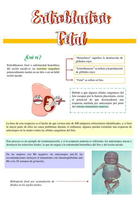 Concepto Eritroblastosis Fetal El Rinc N M Dico Udocz