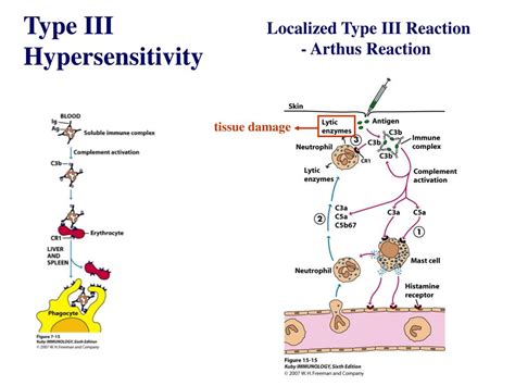 PPT - Chapter 15 Hypersensitivity Reactions PowerPoint Presentation ...