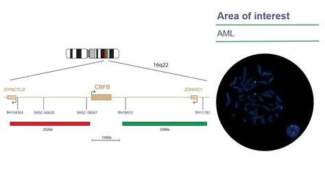 CytoCell CBFB Breakapart FISH Probe OGT