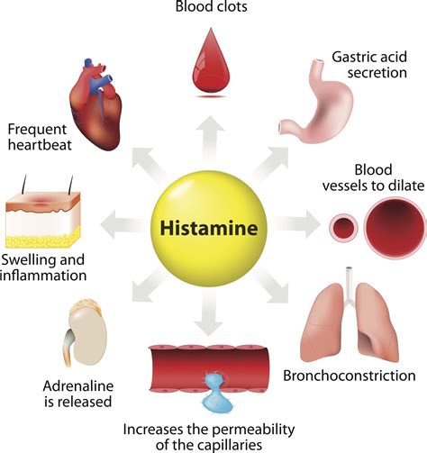 Histamine Intolerance and what you can do about it. - KCH Nutrition